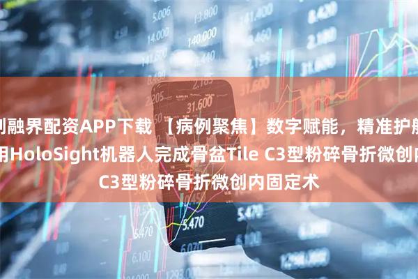 创融界配资APP下载 【病例聚焦】数字赋能,精准护航 医院应用HoloSight机器人完成骨盆Tile C3型粉碎骨折微创内固定术